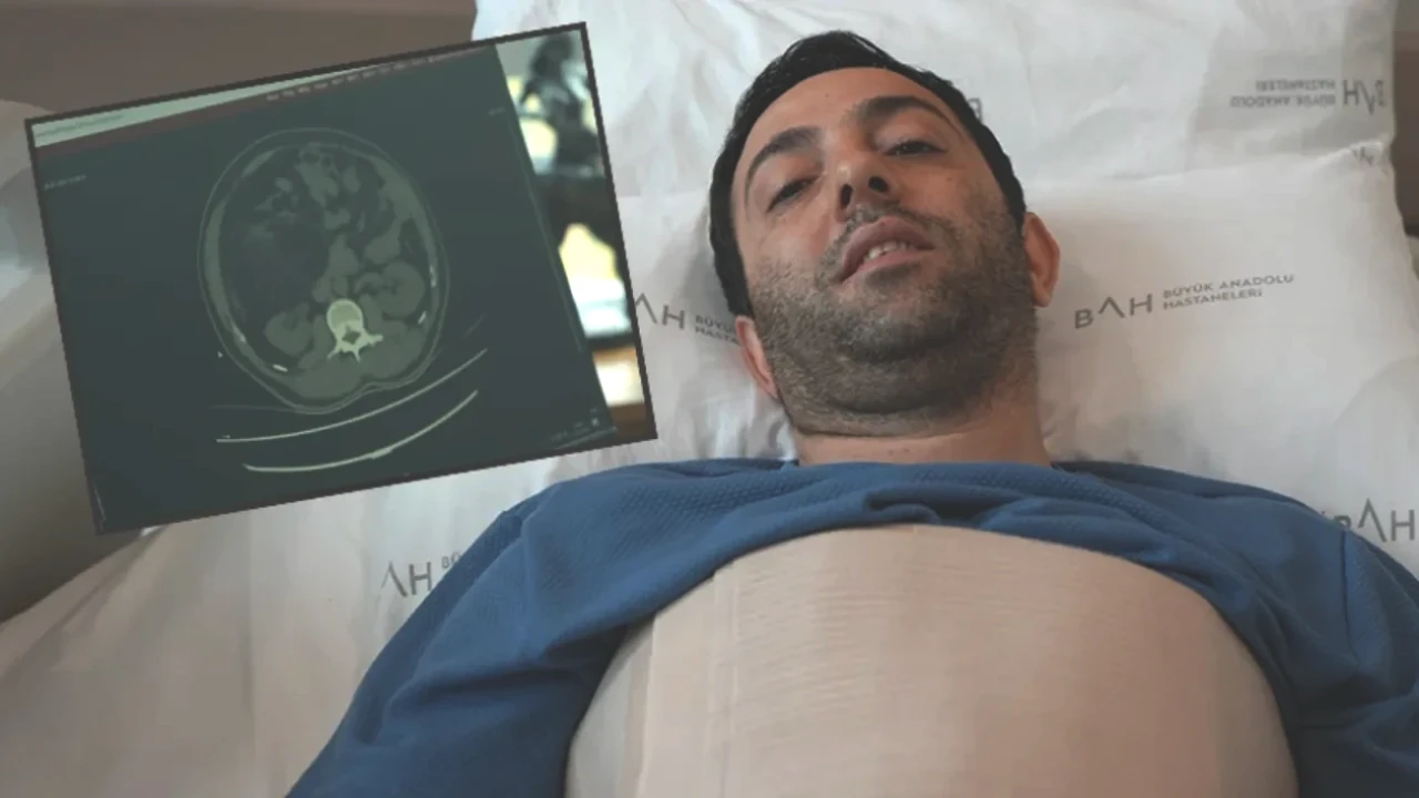 Karın Ağrısıyla Hastaneye Giden Şahıs, Doktorları Şaşkına Çevirdi!